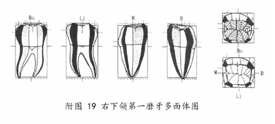 下颌第一磨牙多面体图.png