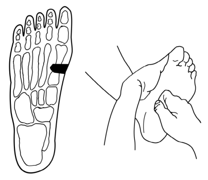 足部反射區保健推拿法--反射區定位-足底部反射區