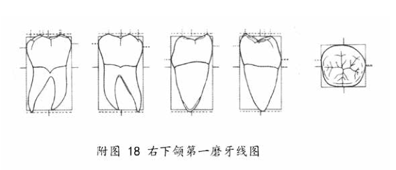 下颌第一磨牙线图2.png