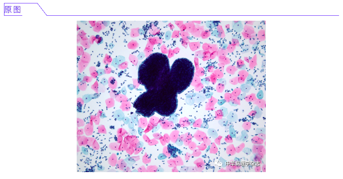 屏幕快照 2021-03-03 下午4.30.35.png