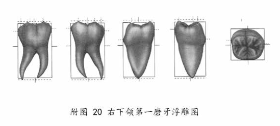 下颌第一磨牙浮雕图.png