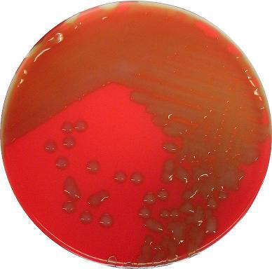 溶血葡萄球菌图片