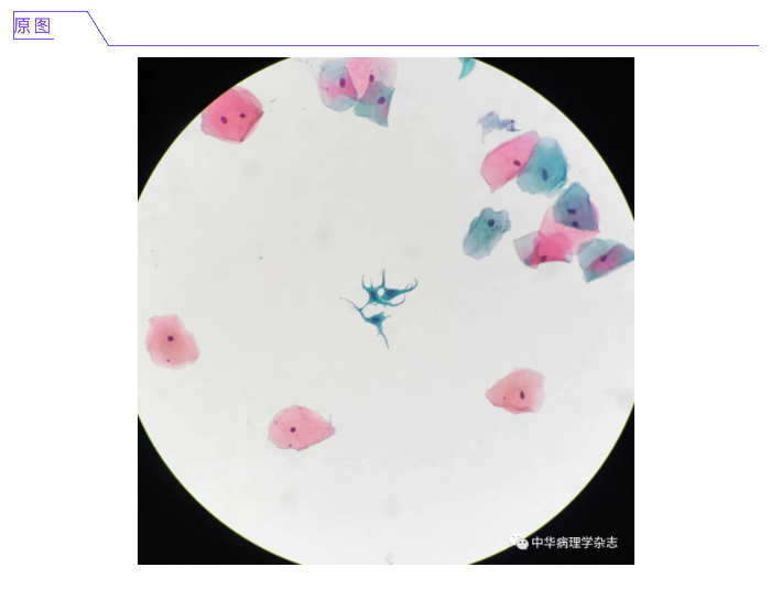 屏幕快照 2021-03-03 下午5.20.14.png