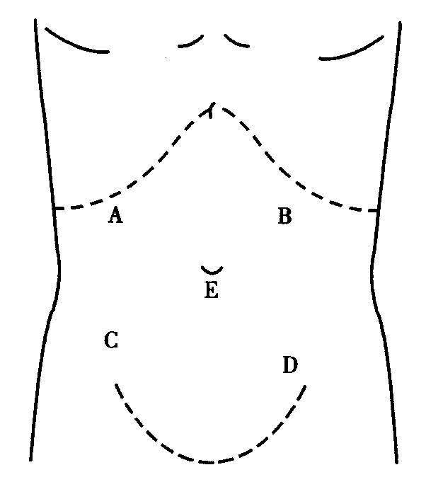 对急性胆囊炎患者进行腹部触诊,最常见的压痛点在http://p