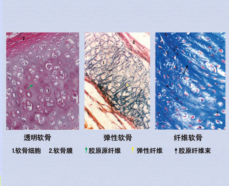 19软骨3类.png