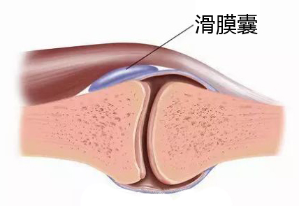 滑膜囊.jpg