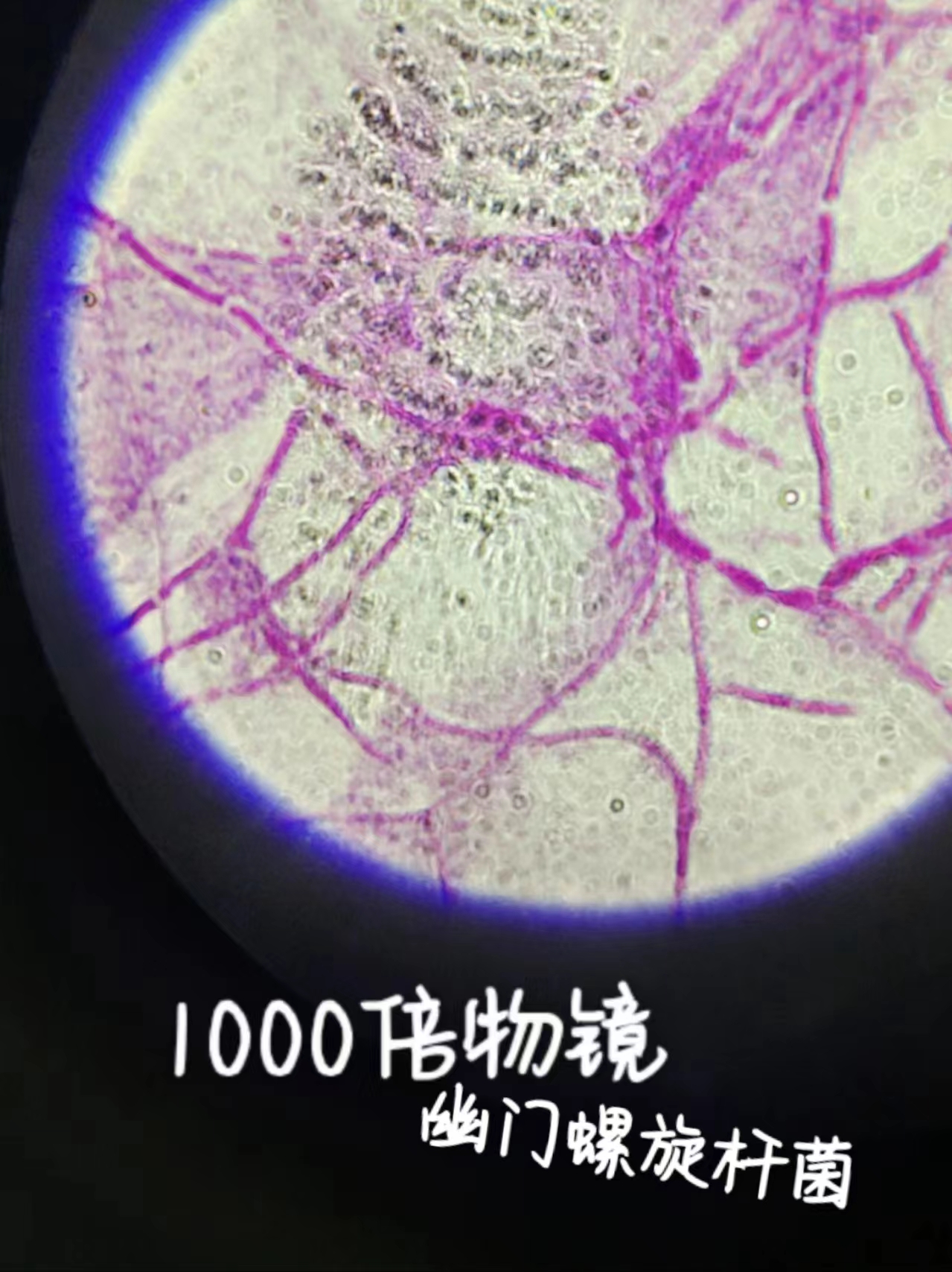 100物镜幽门螺旋杆菌.jpg