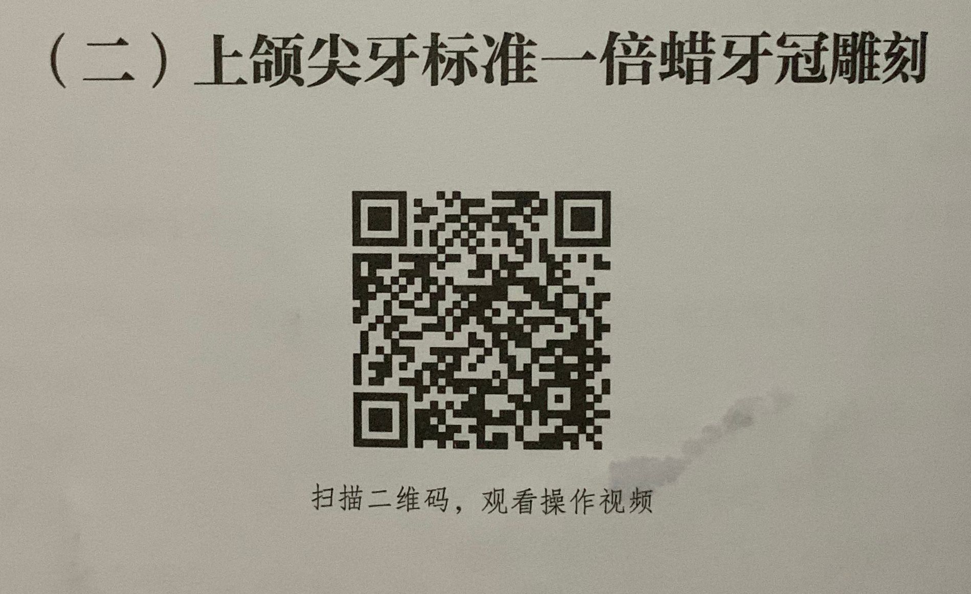 上颌尖牙一倍蜡牙冠雕刻.png