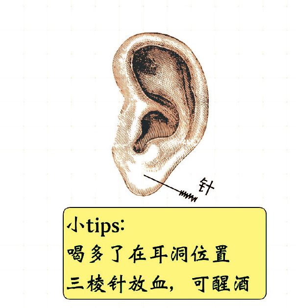 笔记-放血示意图