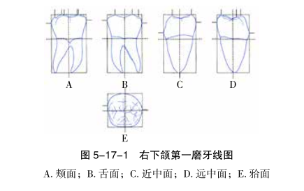 下颌第一磨牙线图1.png