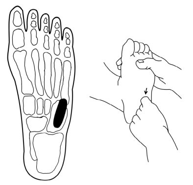 足部反射區保健推拿法--反射區定位-足底部反射區