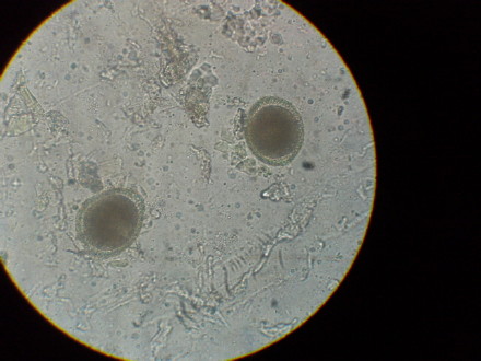 蛔虫卵.jpg
