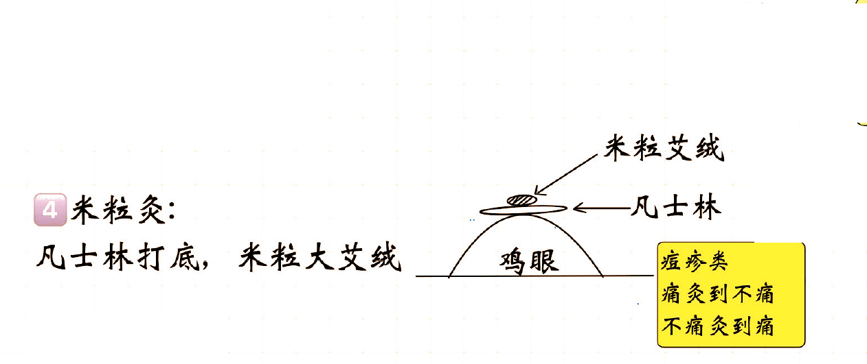 米粒灸演示-笔记